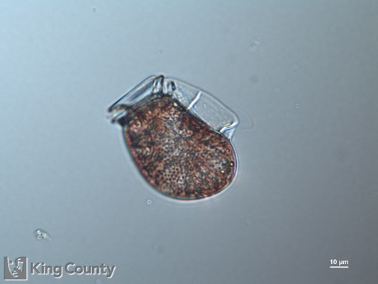 Photo of Dinophysis fortii